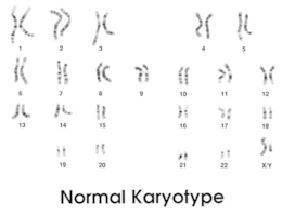 фото: Википедия фото: Википедия