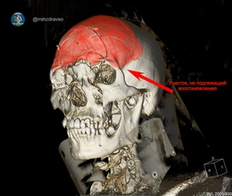 фото: Министерство здравоохранения Свердловской области фото: Министерство здравоохранения Свердловской области